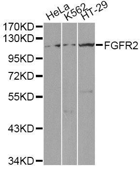Western blot - FGFR2 antibody (144-02074)