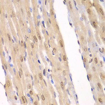 Immunohistochemistry - LIG3 antibody (144-60365)