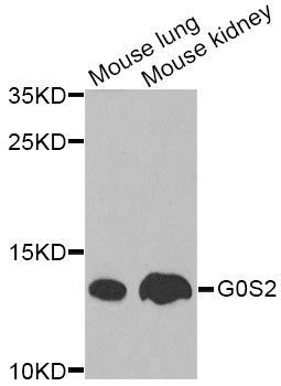 Western blot - G0S2 Antibody (144-09970)