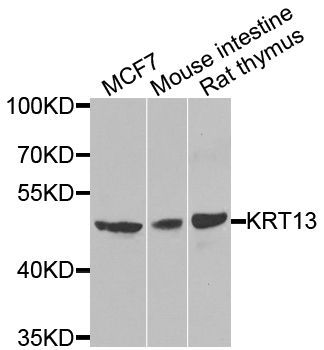 Western blot - KRT13 antibody (144-07697)