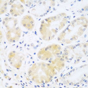 Immunohistochemistry - C5 antibody (144-08104)