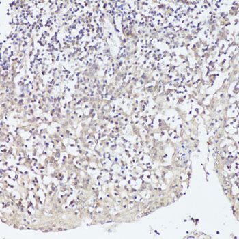 Immunohistochemistry - TWIST1 antibody (144-61361)