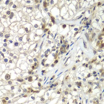 Immunohistochemistry - ASPSCR1 Polyclonal Antibody (144-07481)
