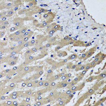 Immunohistochemistry - SCYL1 antibody (144-06735)