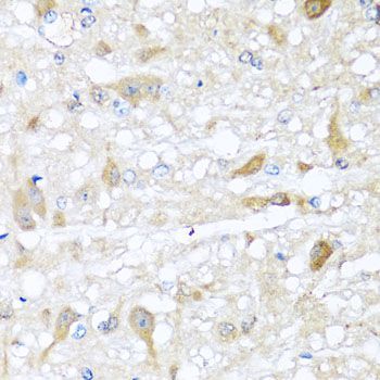 Immunohistochemistry - CBR4 antibody (144-05069)