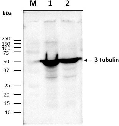 Western blot image