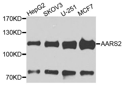 Western blot - AARS2 antibody (144-07826)