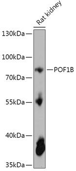 Western blot