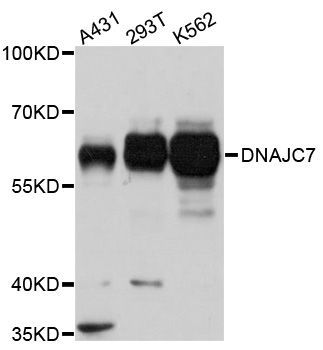 Western blot - DNAJC7 antibody (144-02780)