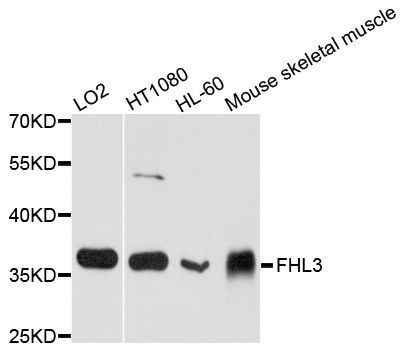 Western blot - FHL3 antibody (144-08679)