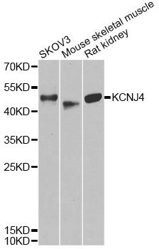 Western blot - KCNJ4 antibody (144-014010)