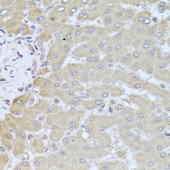 Immunohistochemistry - PDK3 antibody (144-08028)