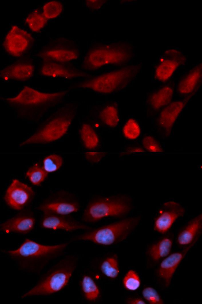 Immunofluorescence - TP53BP1 antibody (144-05757)