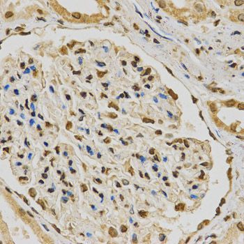 Immunohistochemistry - [KO Validated] HNRNPA2B1 Polyclonal Antibody (144-01162)