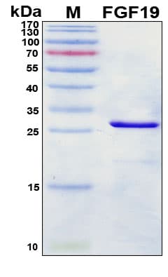 SDS-PAGE Image