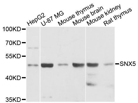 Western blot - SNX5 antibody (144-013160)
