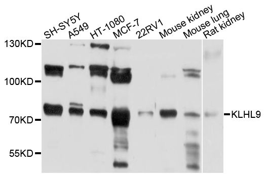 Western blot - KLHL9 Polyclonal Antibody (144-010149)