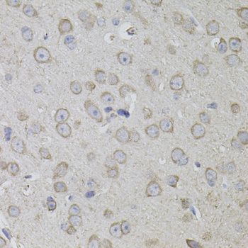 Immunohistochemistry - CD59 antibody (144-01689)