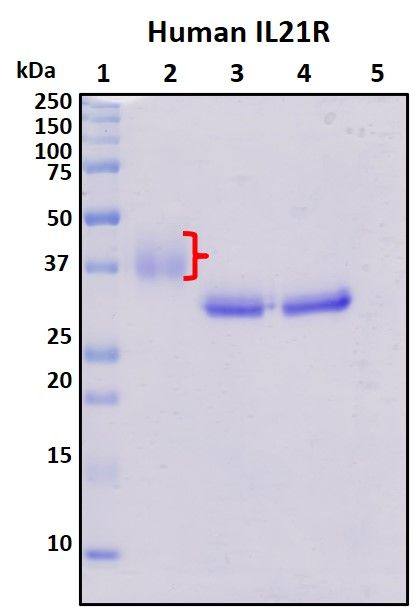 SDS-PAGE