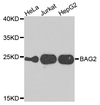 Western blot - BAG2 Polyclonal Antibody (144-07763)