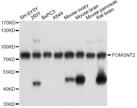 Western blot - POMGNT2 antibody (144-014518)