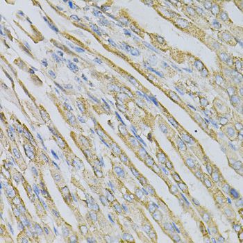 Immunohistochemistry - CDA Polyclonal Antibody (144-013959)