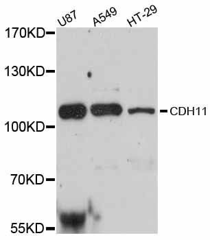 Western blot - CDH11 antibody (144-012176)