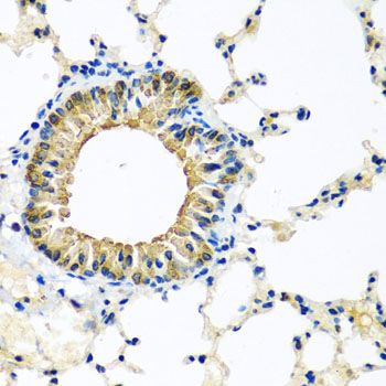 Immunohistochemistry - KCTD15 antibody (144-08256)