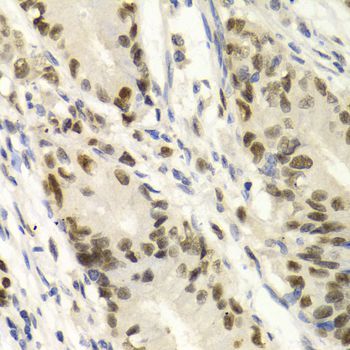 Immunohistochemistry - KPNA4 Antibody (144-02026)