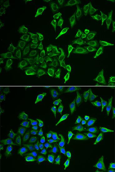 Immunohistochemistry - COX4I1 Polyclonal Antibody (144-06564)