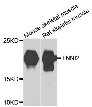 Western blot - TNNI2 antibody (144-07937)