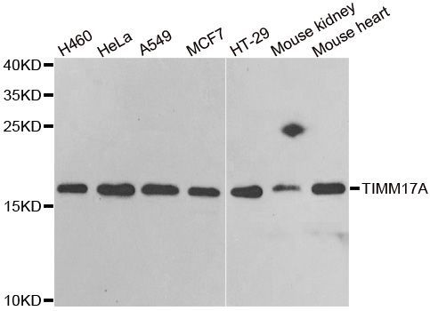 Western blot - TIMM17A Polyclonal Antibody (144-06449)