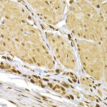 Immunohistochemistry - [KO Validated] S100A4 Polyclonal Antibody (144-01631)