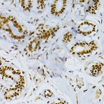Immunohistochemistry - SNRNP70 antibody (144-06065)