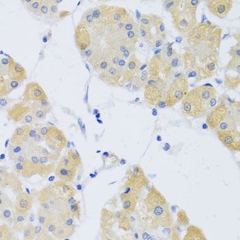 Immunohistochemistry - CLIP1 antibody (144-07722)