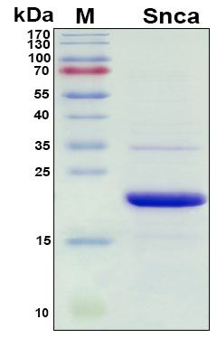 SDS-PAGE