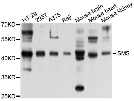 Western blot - SMS antibody (144-09154)