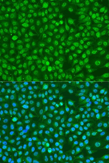 Immunohistochemistry - Phospho-BRCA1-S1423 pAb (144-50232)