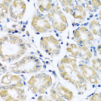 Immunohistochemistry - NDUFB10 Polyclonal Antibody (144-03982)