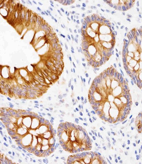 IHC