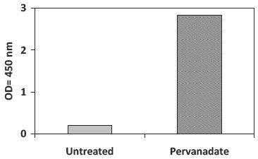 PEL-TYK2-Y-Pervanadate Stimulation of Jurkat Cell Line