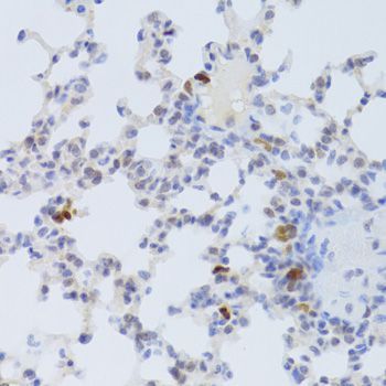 Immunohistochemistry - FCN1 Antibody (144-06587)