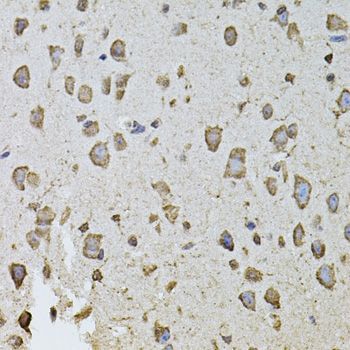 Immunohistochemistry - FGF2 Polyclonal Antibody (144-00235)