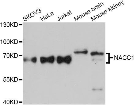 Western blot - NACC1 Antibody (144-11720)
