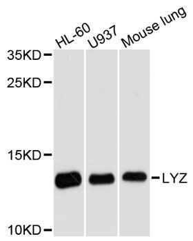 Western blot - LYZ antibody (144-013511)