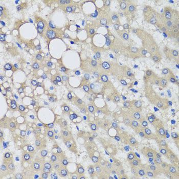Western blot - PRODH Polyclonal Antibody (144-05836)