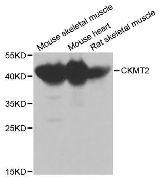 Western blot - CKMT2 Polyclonal Antibody (144-02206)