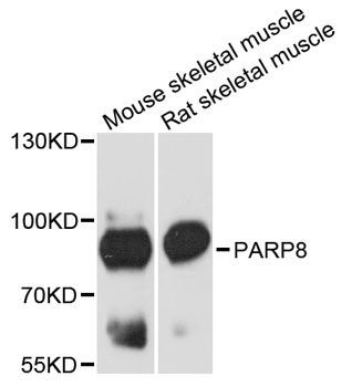 Western blot - PARP8 antibody (144-12894)