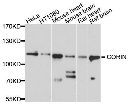 Western blot - CORIN Polyclonal Antibody (144-10404)
