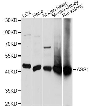 Western blot - ASS1 antibody (144-61329)